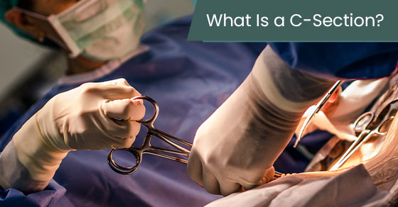 What is a C-section?